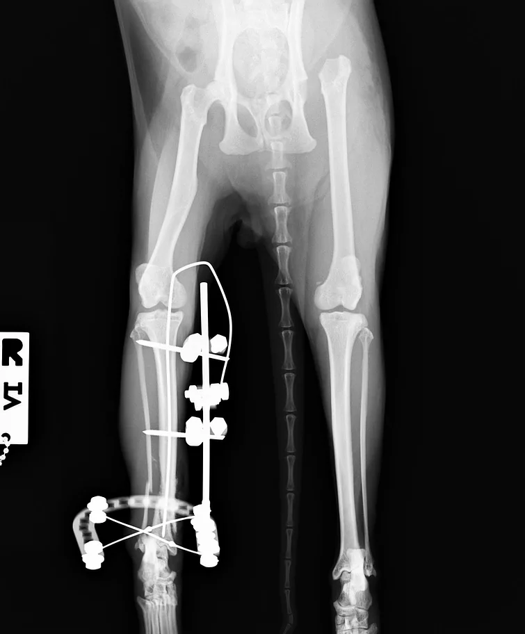 Case #002: 猫　交通事故　脛腓骨遠位端　粉砕　開放骨折 | その他