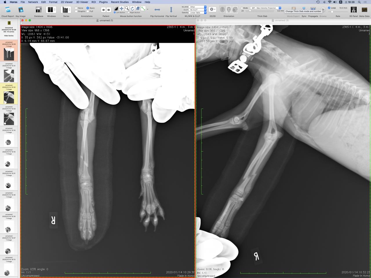 Case #070: 橈尺骨骨折のトイプードルBW1.90kg。AO分類：2-2-A2 | 骨折
