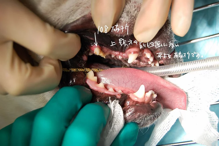 Case #042: フレンチブルの上顎第4前臼歯破折／抜歯 | 歯科