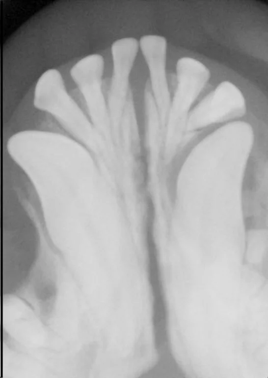Case #050: 左下顎犬歯(304)、第１前臼歯(305)の含歯性嚢胞のフレンチブルドッグ | 歯科