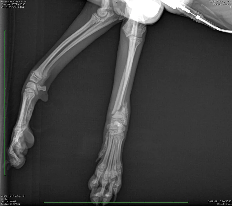 Case #058: BW1.30kgのトイプードルの橈尺骨骨折　AO 2-3-1 | 骨折