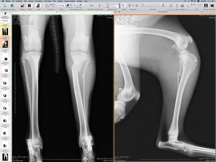 Case #071: スタンダードプードル、脛腓骨近位1／3ほぼ単純斜骨折。AO分類4-1-A2 | 骨折